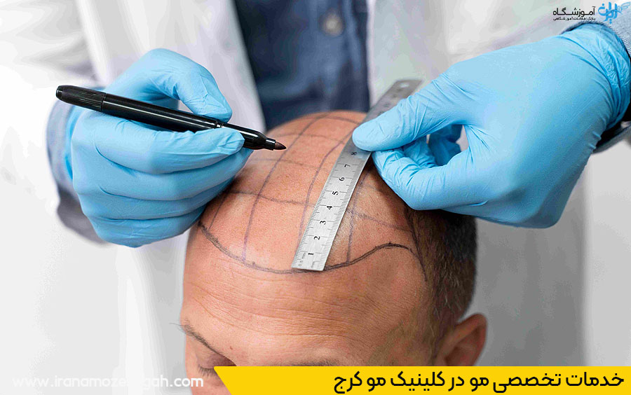 خدمات تخصصی کلینیک مو کرج