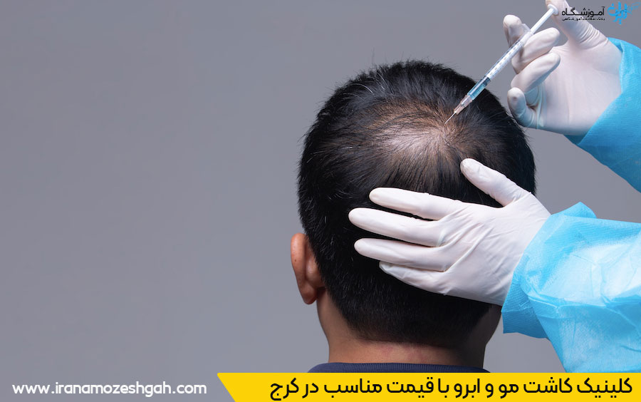 کلینیک مو کرج قیمت مناسب