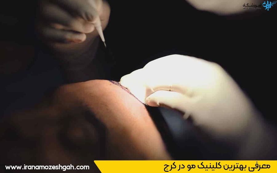 بهترین کلینیک مو کرج 