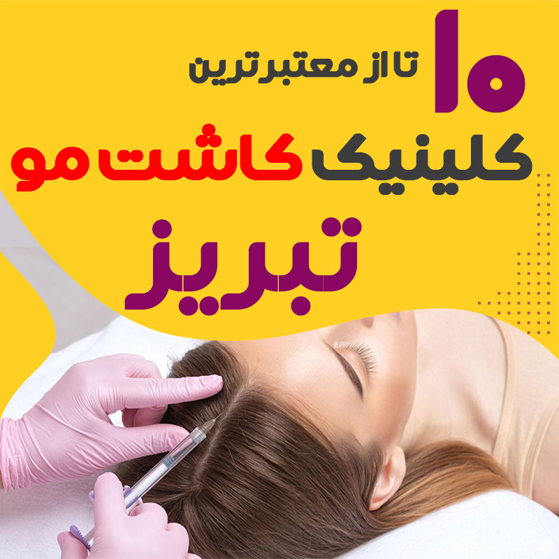 بهترین مراکز کاشت مو تبریز
