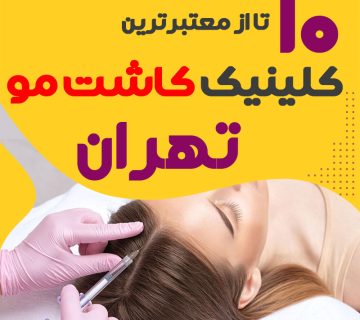 بهترین مراکز کاشت مو تهران