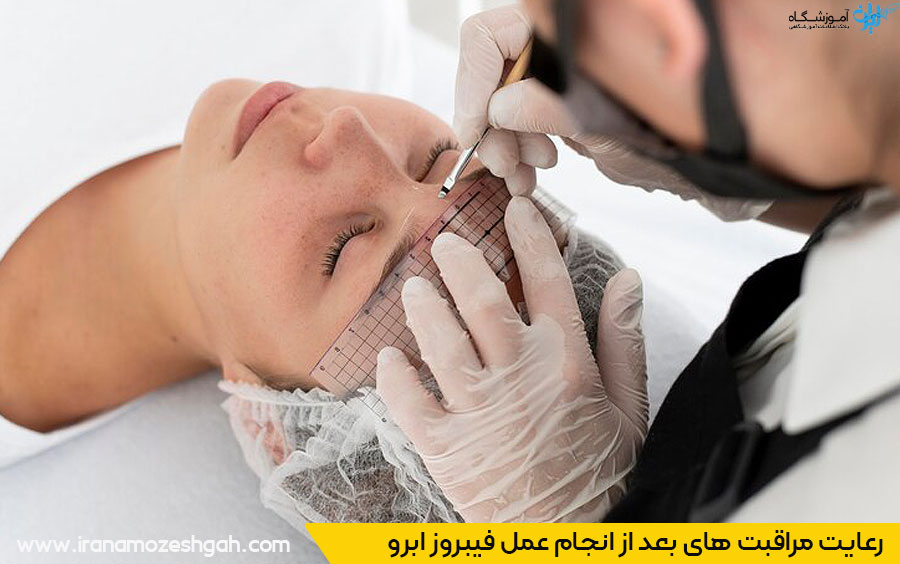 مراقبت بعد از انجام عمل فیبروز ابرو