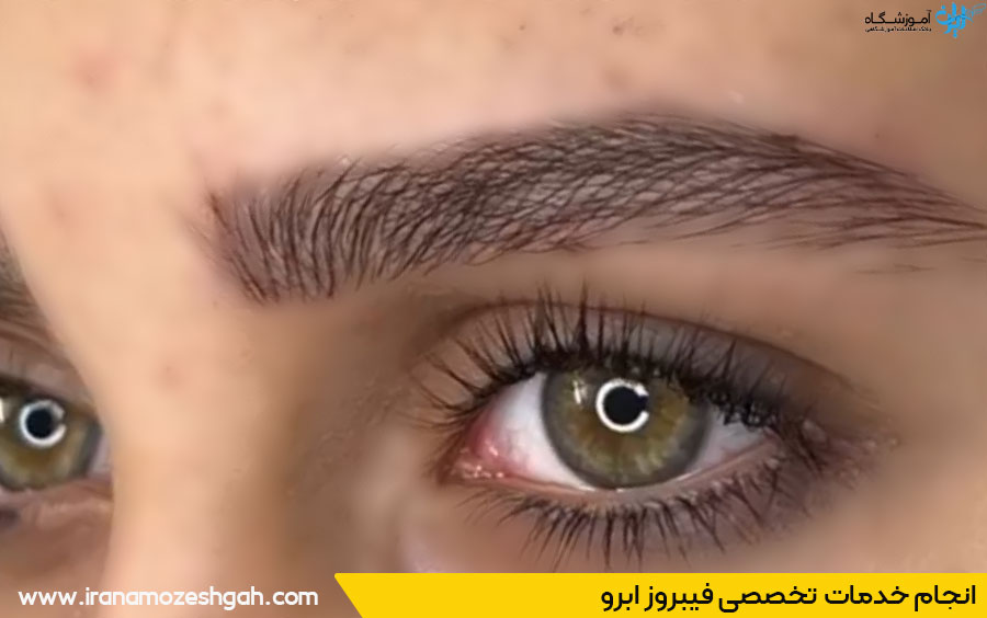 مرکز تخصصی فیبروز ابرو