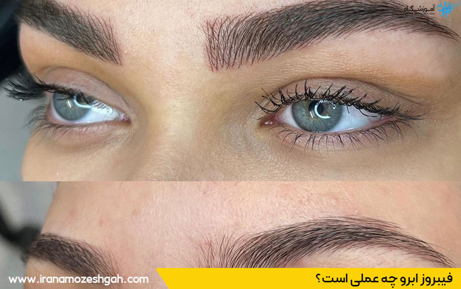 فیبروز ابرو