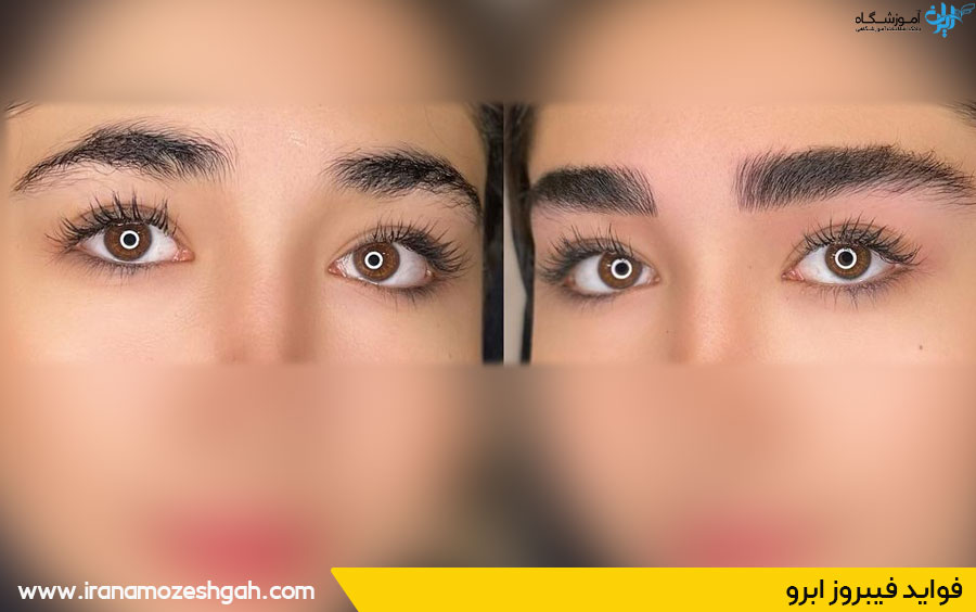 فواید فیبروز ابرو