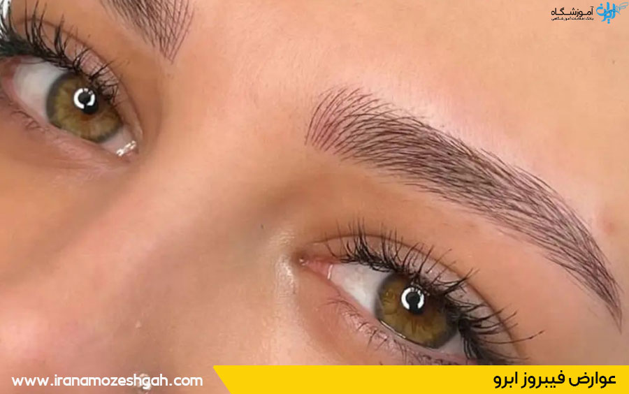 عوارض فیبروز ابرو