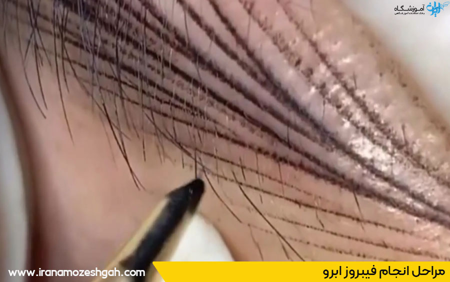 مراحل فیبروز ابرو