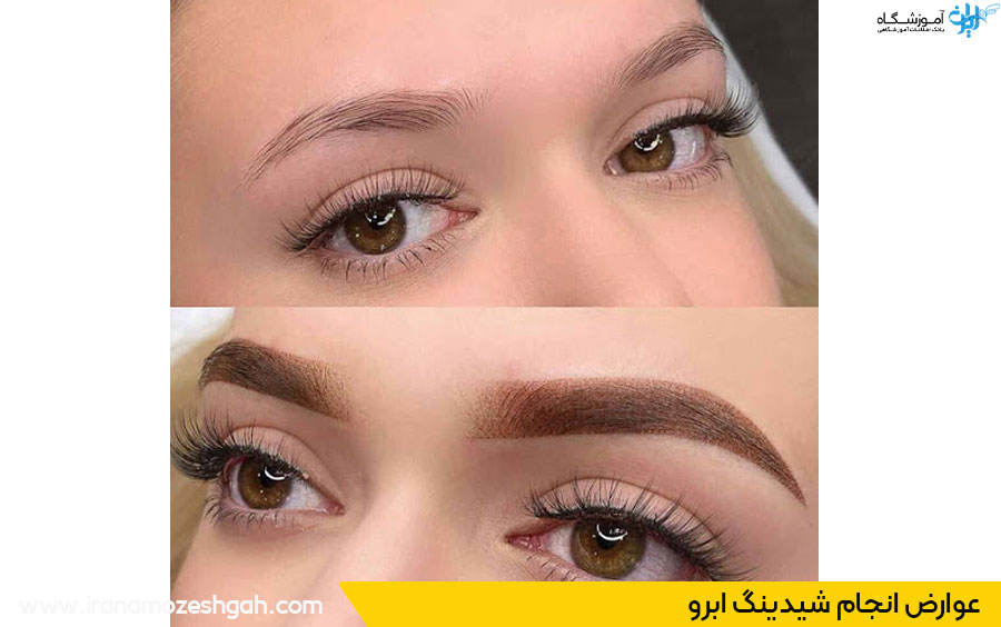 معایت شیدینگ ابرو