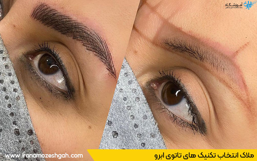 فرق بین فیبروز و بولد بروز