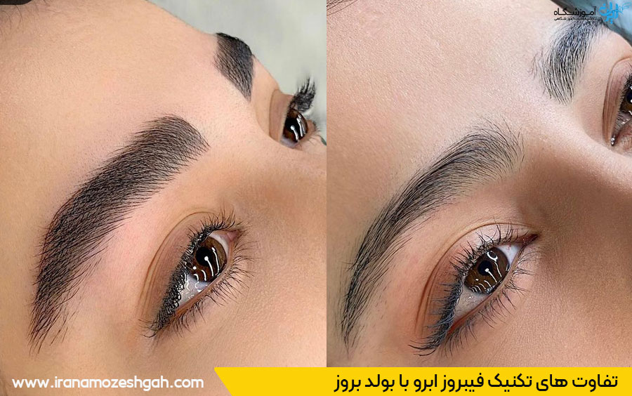 فرق بین فیبروز و بولد بروز