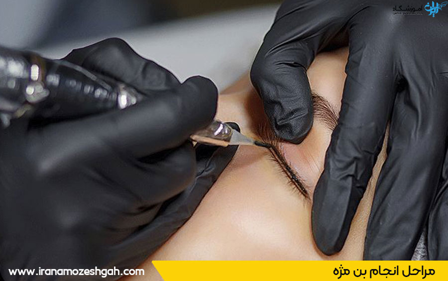 بن مژه 