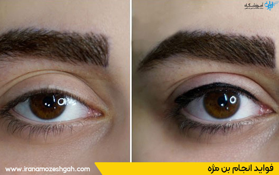 مزایای انجام بن مژه