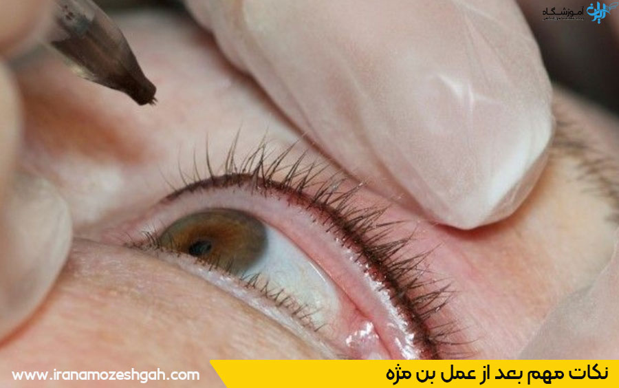مراقبت بعد از بن مژه