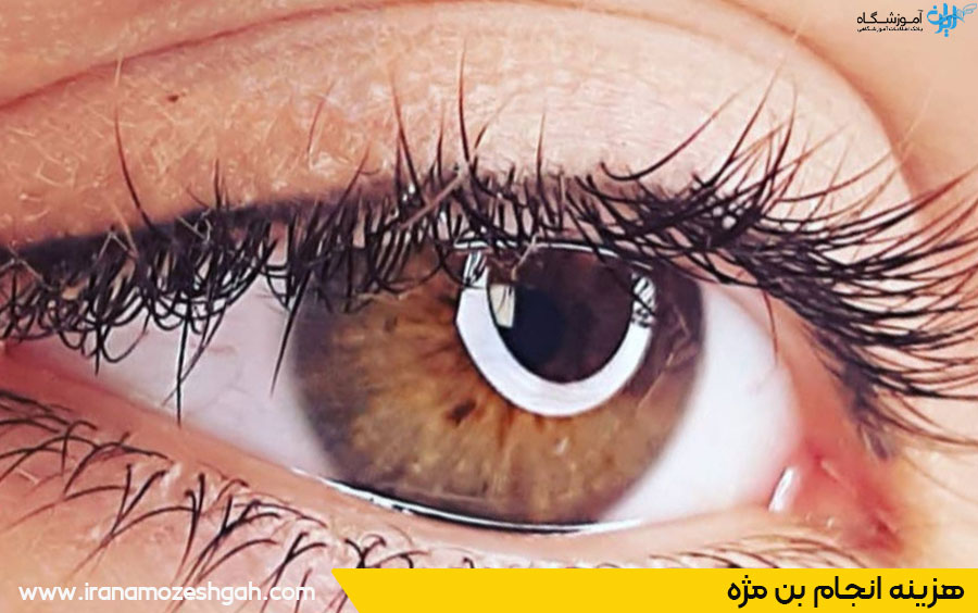 قیمت بن مژه