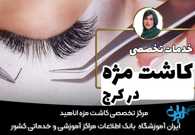 مرکز تخصصی کاشت مزه آناهید
