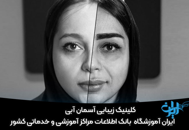 کلینیک زیبایی آسمان آبی