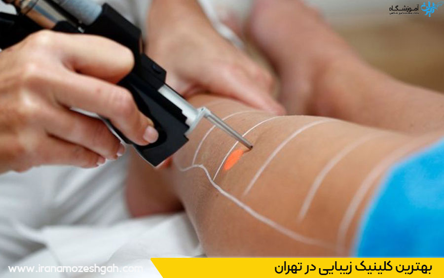 بهترین مرکز لیزر مو در تهران