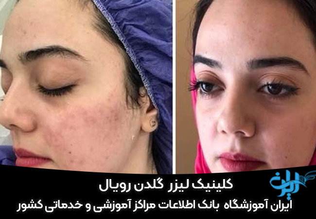 کلینیک لیزر گلدن رویال