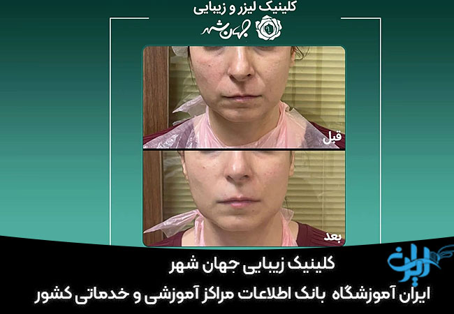 کلینیک زیبایی جهان شهر