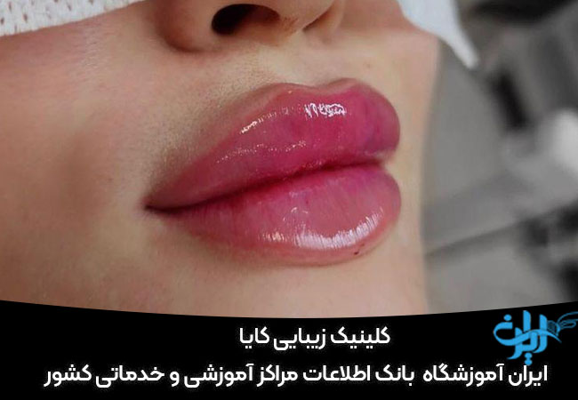 کلینیک زیبایی کایا کرج