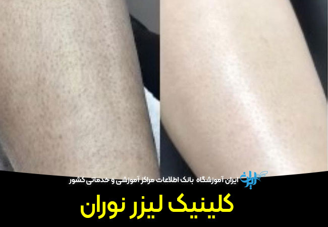 کلینیک زیبایی نوران
