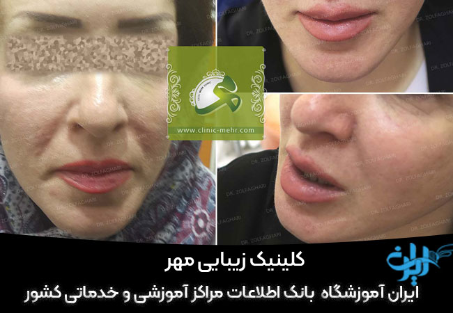 کلینیک زیبایی مهر کرج