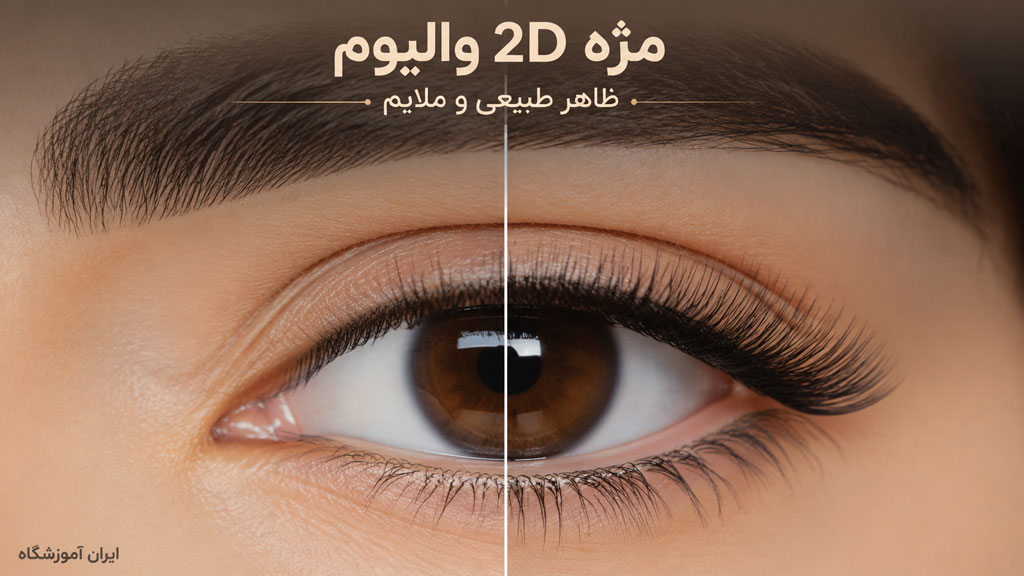 آکستنشن والیوم 2d