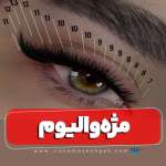 کاشت مژه والیوم