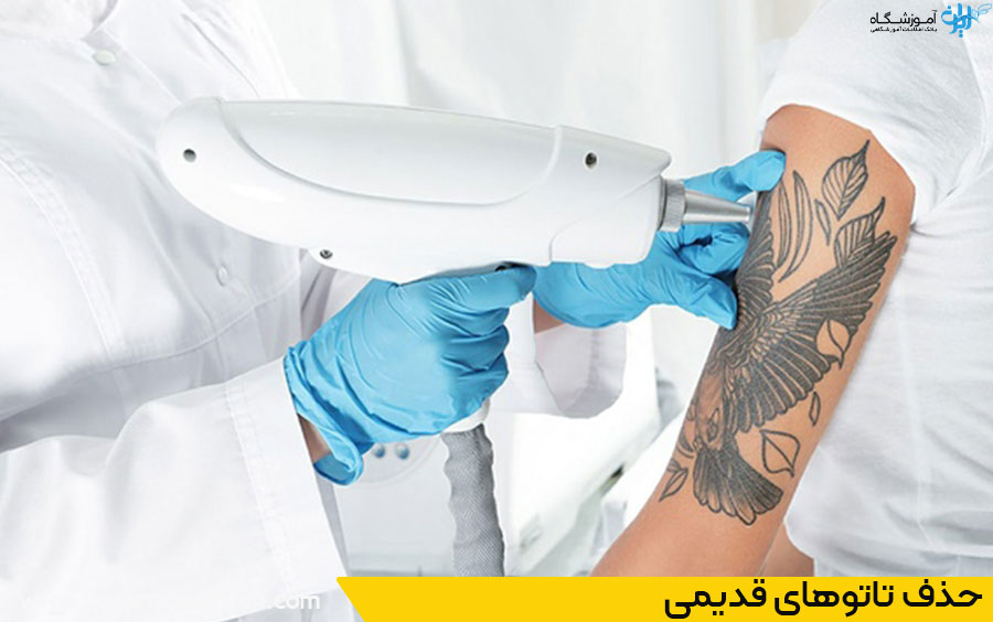 بهترین مراکز آموزش ریموو تاتو در عظیمیه