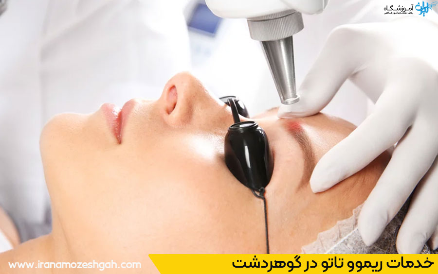 ریموو تاتو در گوهردشت