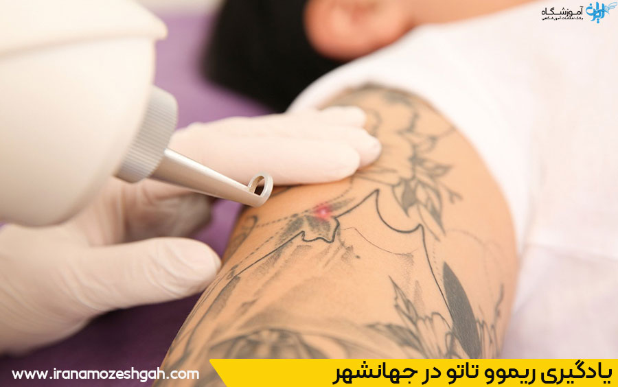 مراکز آموزش ریموو تاتو در جهانشهر