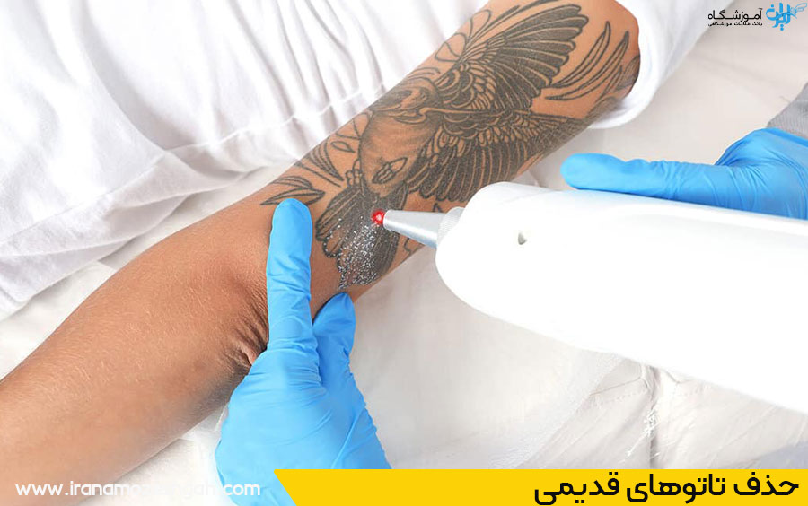 بهترین مراکز آموزش ریموو تاتو در مهرشهر
