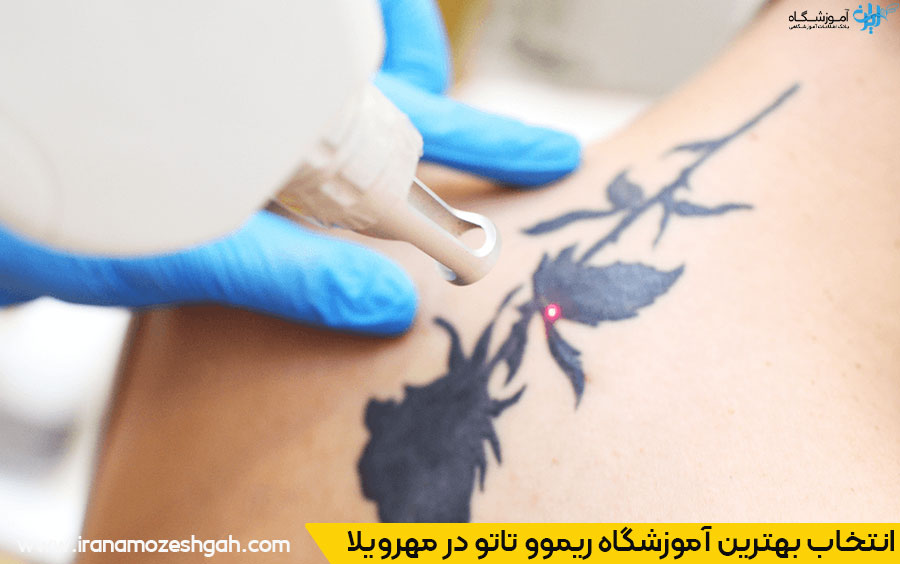 بهترین مراکز آموزش ریموو تاتو در مهرویلا