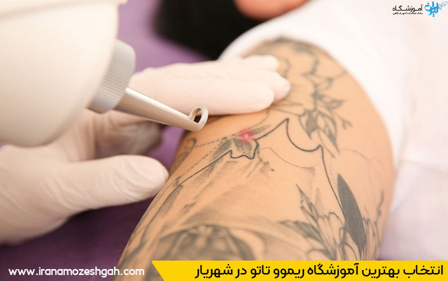 بهترین مراکز آموزش ریموو تاتو در شهریار