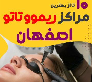 ریموو تاتو در اصفهان