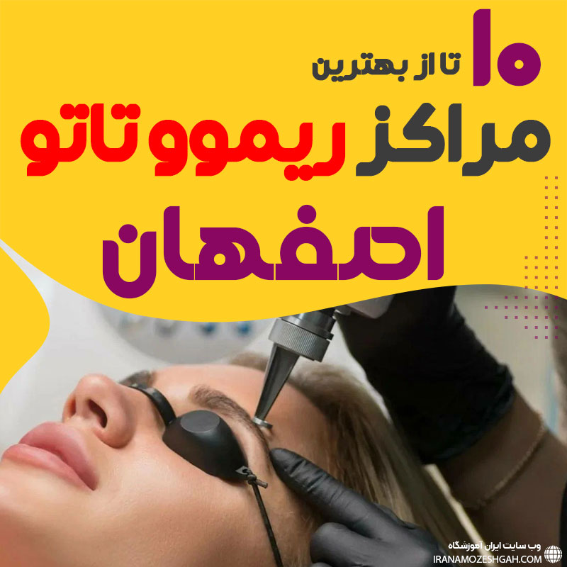 ریموو تاتو در اصفهان