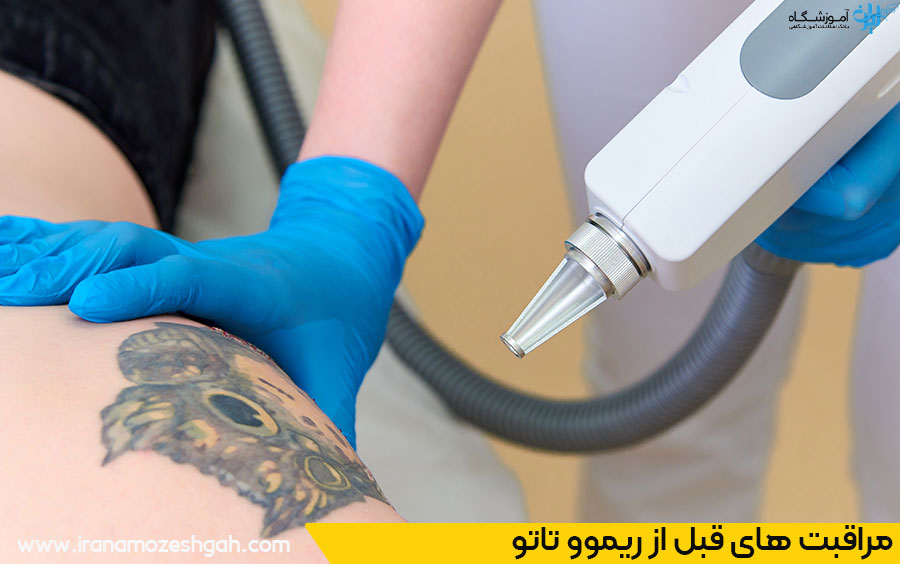 مراقبت های بعد از ریموو تاتو بدن