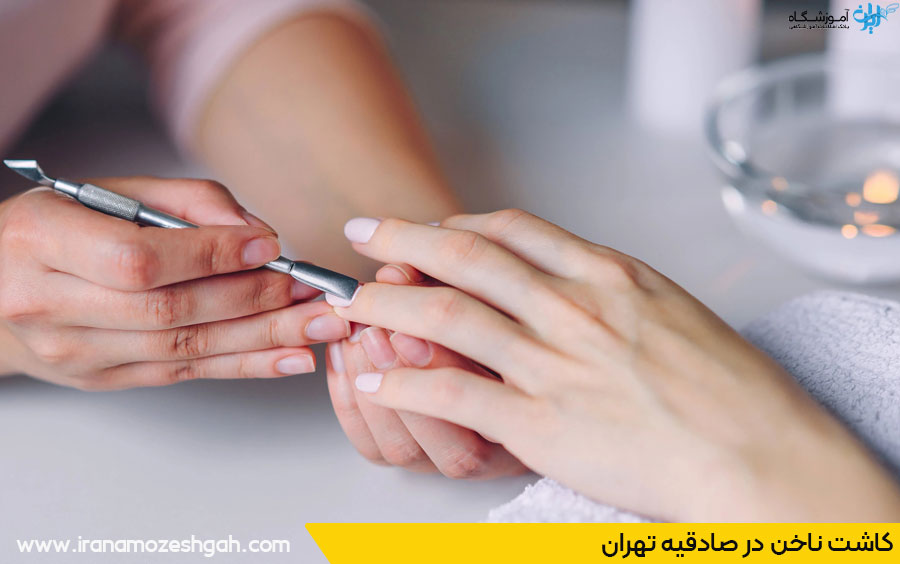 کاشت ناخن در صادقیه