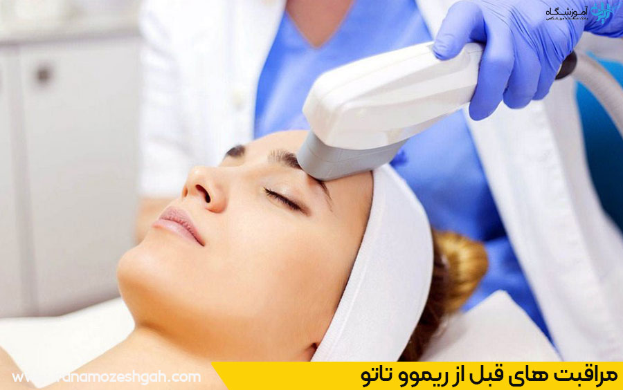 نکات مهم قبل از ریموو تاتو