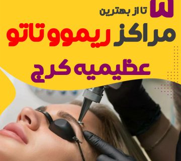 ریموو تاتو در عظیمیه