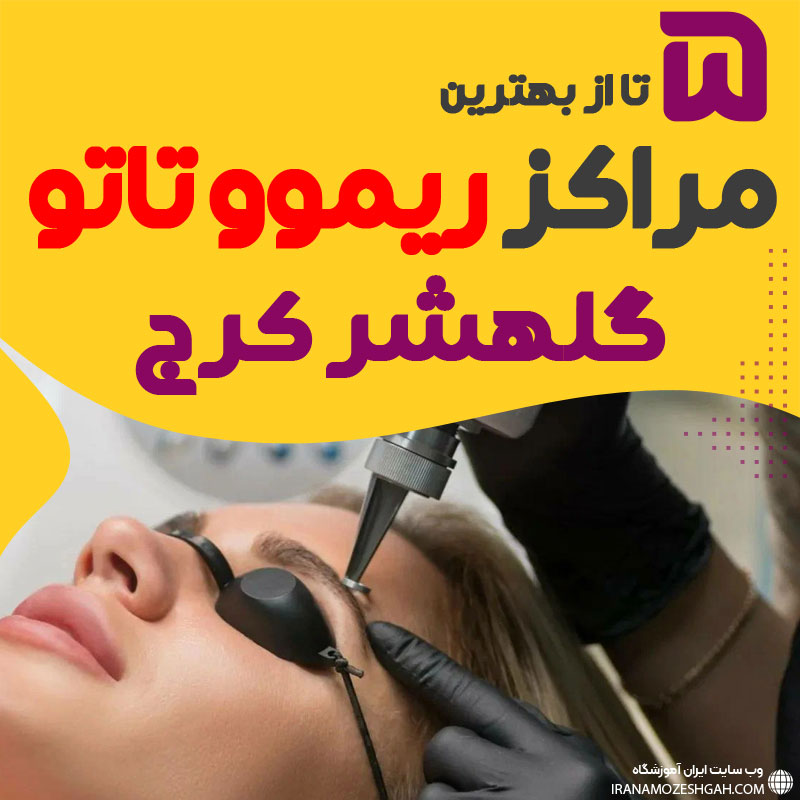 ریموو تاتو در گلشهر