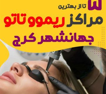 ریموو تاتو در جهانشهر