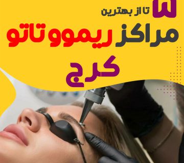 ریموو تاتو در کرج