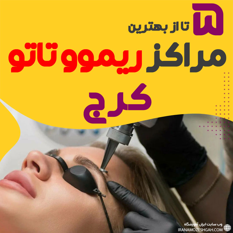 ریموو تاتو در کرج