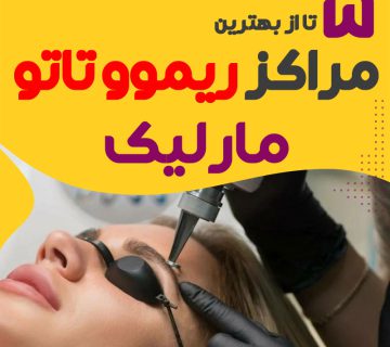 ریموو تاتو در مارلیک