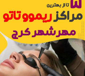 ریموو تاتو در مهرشهر