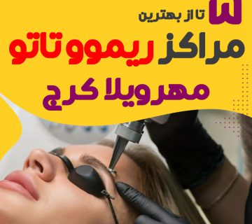 Rymvv tatv dr mhrvyla khdmat v amvzsh rymvv ttv abrv svrt v bdn 360x320