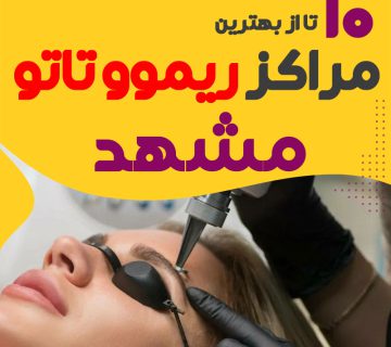 ریموو تاتو در مشهد