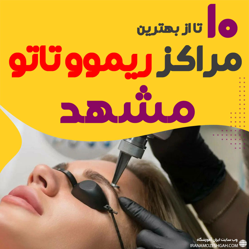 ریموو تاتو در مشهد