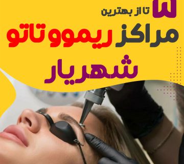 ریموو تاتو در شهریار